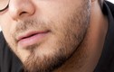 Nam giới để râu sẽ phòng tránh được ung thư?