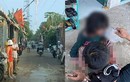 Đồng Nai: Nghi ghen tuông, gã đàn ông dùng xăng đốt phòng trọ khiến 7 người bị bỏng nặng