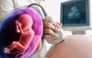 Bị cạn ối khi nào thì nguy hiểm cho thai nhi?