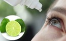 Chuyên gia giật mình trước trào lưu nhỏ nước chanh vào mắt chữa bệnh, nguy cơ mù vĩnh viễn là rất cao