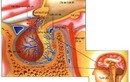 Những điều cần biết về cách điều trị ung thư não