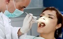 Khi nào nên đi lấy cao răng?