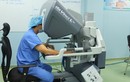 Robot cắt ung thư thận có chồi bướu trong tĩnh mạch chủ bụng