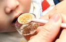Trẻ viêm phổi vì cho dùng kháng sinh không đúng