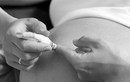 Bị tiểu đường thai kỳ nên sinh mổ hay sinh thường?