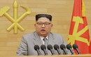 Chuyên gia Hàn Quốc hé lộ sức khỏe của ông Kim Jong-un