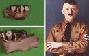 Sự thật sốc về trùm phát xít Hitler qua bí mật trong hàm răng