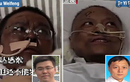 Màu da của bác sĩ nhiễm COVID-19 ở Vũ Hán thay đổi bất thường