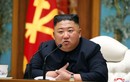CNN: Nhà lãnh đạo Triều Tiên Kim Jong-un vừa được phẫu thuật