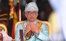 Nhà vua Malaysia nhập viện