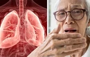 Triệu chứng nhiễm trùng phổi ít người để ý