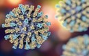 Virus sởi đột biến liên quan đến bệnh viêm não gây tử vong