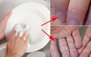 Rửa bát bằng tay nên tránh 6 sai lầm kẻo tốn tiền hại da