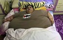 Bi kịch của người béo nhất thế giới với cân nặng 501kg