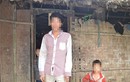 Những đứa trẻ có 2 “của quý” lạ lùng ở Hà Giang 