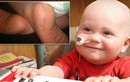 Ngắm bé ung thư 2 tuổi siêu “cute“