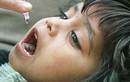 114 trẻ nhập viện khẩn cấp vì uống nhầm vaccine