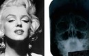 Lộ bằng chứng Marilyn Monroe phẫu thuật thẩm mỹ