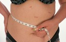 1001 biến chứng sau phẫu thuật cắt dạ dày giảm cân
