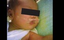 Rúng động y tá dán băng dính cấm bé 5 ngày tuổi khóc