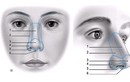 “Bóc mẽ” công nghệ nâng mũi Sline-3D “ồn ào” nhất hiện nay 