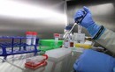 Vắc xin Ebola an toàn trong giai đoạn thử nghiệm đầu tiên