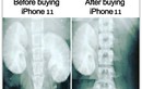 Chờ ra mắt iPhone 11, dân mạng chế ảnh “bán thận“ mua siêu phẩm "táo cắn dở"