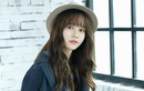 Kim So Hyun bất ngờ bị thương tại trường quay