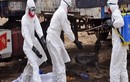 Bệnh nhân ebola được cứu sống nhờ thuốc HIV