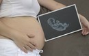 8 hoạt động ngạc nhiên em bé làm trong bụng mẹ