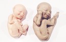 Sốt mô hình bào thai 3D cho các mẹ bầu