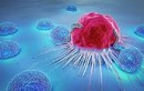 4 bệnh vặt không chữa sớm dễ chuyển thành ung thư