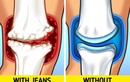 Diện jeans bó sát, người mặc khổ vì “phá” dáng, “đầu độc” sức khỏe