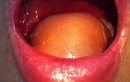 Cận cảnh ca tái tạo lưỡi cho bệnh nhân ung thư