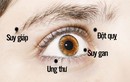 Video: Có dấu hiệu này ở mắt không khám ngay bạn sẽ hối hận cả đời
