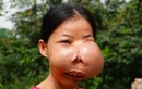 Người phụ nữ 15 năm mang "gương mặt của quỷ" ở Phú Thọ