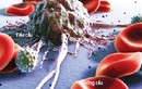 Phát hiện protein ngăn chặn di căn ung thư máu 