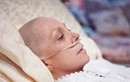 Biểu hiện của bệnh nhân ung thư giai đoạn cuối 
