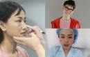 Loạt sao Việt không ngại công khai phẫu thuật thẩm mỹ