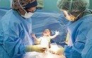 Bác sĩ cắt cụt ngón tay trẻ sơ sinh trong lúc mổ lấy thai 