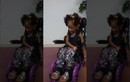 Cô bé 4 tuổi phải ngồi xe lăn cả đời sau khi nhổ răng