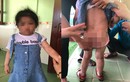 Dì ruột đánh cháu gái nhập viện ở Hà Tĩnh: Có khởi tố vụ án?