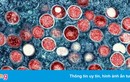 Người nhiễm virus Mpox gây bệnh đậu mùa khỉ nên đi xét nghiệm HIV