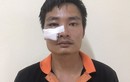 Bắt khẩn cấp người đàn ông tông gãy chân CSGT ở Bắc Giang