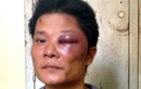Chân dung đối tượng cả gan chém, cướp súng CA Quảng Ninh