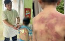 Cha bạo hành con ruột ở Đồng Nai: Dùng dây sạc, xẻng nấu ăn đánh con 