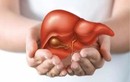 Dấu hiệu “cầu cứu” của gan, cần thải độc thanh lọc ngay