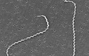 Suýt mất mạng do nhiễm Leptospira - hiểm hoạ từ chuột, ai dễ mắc?