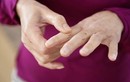 7 lý do khiến ngón tay bạn sưng phù