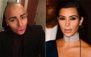 Fan cuồng Kim Kardashian phá nát khuôn mặt để giống thần tượng